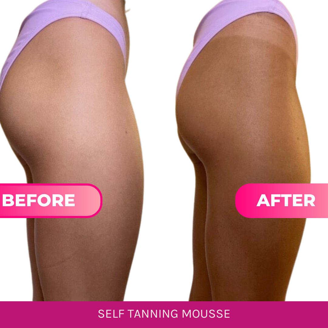 Beettan LLC - BEETTAN Self Tanning Mousse (Medium-Dark)
