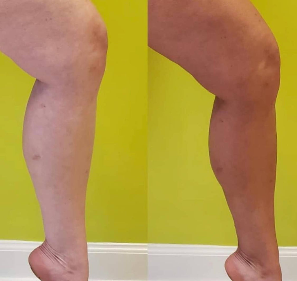 Beettan LLC - BEETTAN Self Tanning Mousse (Medium-Dark)